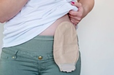  Grupo gratuito oferece apoio a pessoas ostomizadas em Dourados 