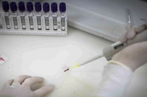 Paciente em SP com suspeita de ebola testa positivo para meningite