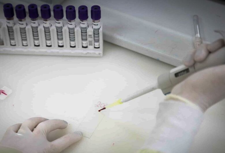Testes para o vírus Ebola continuam em andamento - Crédito: PABLO JACOB/GOVERNO DE SP